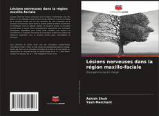 Bookcover of Lésions nerveuses dans la région maxillo-faciale