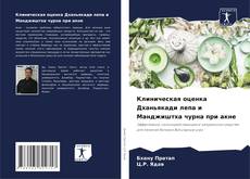 Bookcover of Клиническая оценка Дханьякади лепа и Манджиштха чурна при акне