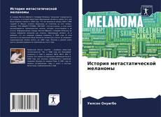 Buchcover von История метастатической меланомы