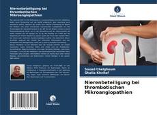 Nierenbeteiligung bei thrombotischen Mikroangiopathien的封面