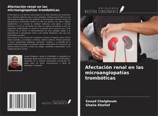 Bookcover of Afectación renal en las microangiopatías trombóticas
