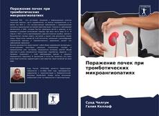 Buchcover von Поражение почек при тромботических микроангиопатиях