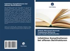 Buchcover von Infektiöse Komplikationen bei offenen Beinfrakturen
