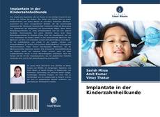 Implantate in der Kinderzahnheilkunde的封面