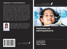 Copertina di Implantes en odontopediatría