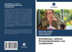 Schilddrüse: seltene Primärlokalisation von Lymphomen kitap kapağı