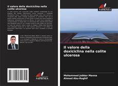 Capa do livro de Il valore della doxiciclina nella colite ulcerosa 