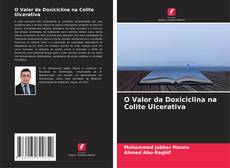 O Valor da Doxiciclina na Colite Ulcerativa的封面