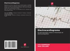 Borítókép a  Electrocardiograma - hoz