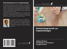 Bookcover of Osteointegración en implantología