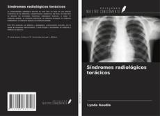 Bookcover of Síndromes radiológicos torácicos