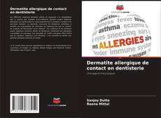 Capa do livro de Dermatite allergique de contact en dentisterie 