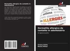 Bookcover of Dermatite allergica da contatto in odontoiatria