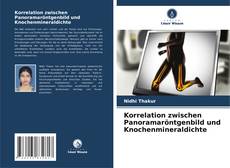 Korrelation zwischen Panoramaröntgenbild und Knochenmineraldichte kitap kapağı