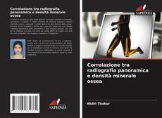 Buchcover von Correlazione tra radiografia panoramica e densità minerale ossea