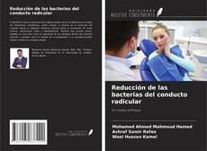 Bookcover of Reducción de las bacterias del conducto radicular