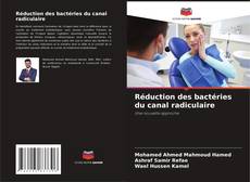 Buchcover von Réduction des bactéries du canal radiculaire