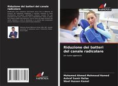 Обложка Riduzione dei batteri del canale radicolare