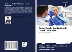Обложка Redução de bactérias do canal radicular