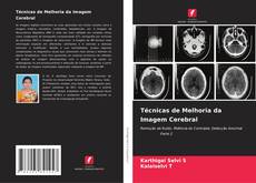 Bookcover of Técnicas de Melhoria da Imagem Cerebral