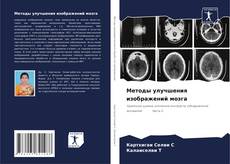 Borítókép a  Методы улучшения изображений мозга - hoz