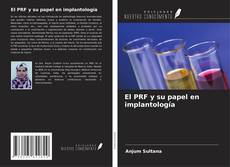 Capa do livro de El PRF y su papel en implantología 