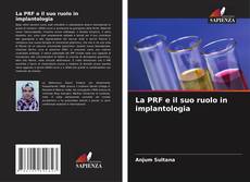 La PRF e il suo ruolo in implantologia的封面