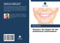 Veneers: Ein Segen für die ästhetische Zahnmedizin kitap kapağı