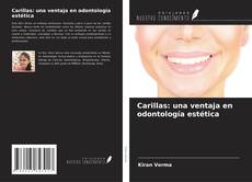 Capa do livro de Carillas: una ventaja en odontología estética 
