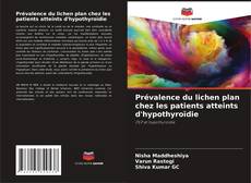 Buchcover von Prévalence du lichen plan chez les patients atteints d'hypothyroïdie