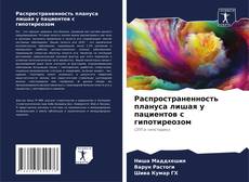 Buchcover von Распространенность плануса лишая у пациентов с гипотиреозом