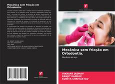 Couverture de Mecânica sem fricção em Ortodontia.