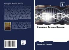Copertina di Синдром Таунса Брокса