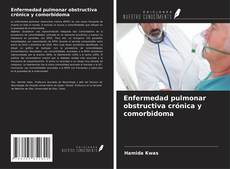 Buchcover von Enfermedad pulmonar obstructiva crónica y comorbidoma