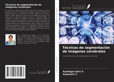 Bookcover of Técnicas de segmentación de imágenes cerebrales