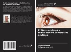 Bookcover of Prótesis oculares y rehabilitación de defectos oculares