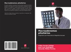 Buchcover von Macroadenomas pituitários