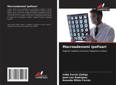 Couverture de Macroadenomi ipofisari