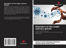 Couverture de Disorders of the major salivary glands