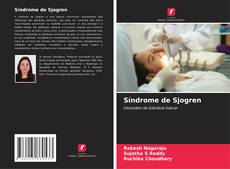 Síndrome de Sjogren的封面