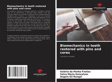 Обложка Biomechanics in teeth restored with pins and cores