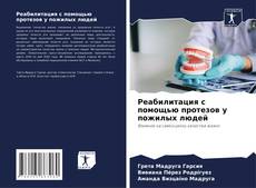 Bookcover of Реабилитация с помощью протезов у пожилых людей