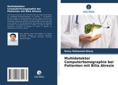 Bookcover of Multidetektor Computertomographie bei Patienten mit Bilia Atresie
