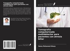 Bookcover of Tomografía computarizada multidetector para pacientes con atresia biliar
