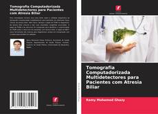 Tomografia Computadorizada Multidetectores para Pacientes com Atresia Biliar的封面