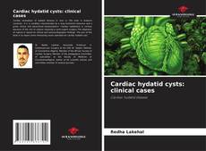 Bookcover of Cardiac hydatid cysts: clinical cases