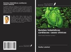 Bookcover of Quistes hidatídicos cardíacos: casos clínicos