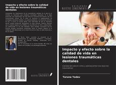 Impacto y efecto sobre la calidad de vida en lesiones traumáticas dentales的封面