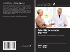 Borítókép a  Arteritis de células gigantes - hoz