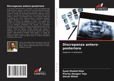 Bookcover of Discrepanza antero-posteriore